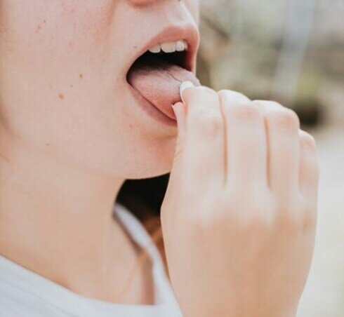 Bacterial Tonsillitis